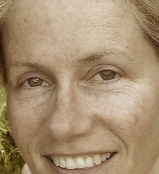 forehead creases; crows feet