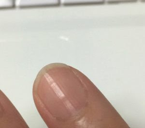 身体がsos 爪に出る不調のサインとは 爪のへこみ 横筋 縦筋ができたら Tula