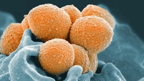 Evolving Strep
