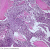 Prostate Cancer Diagnosis Grading - Anatomic and functional imaging in the diagnosis of spine - But hearing the words can still be scary.