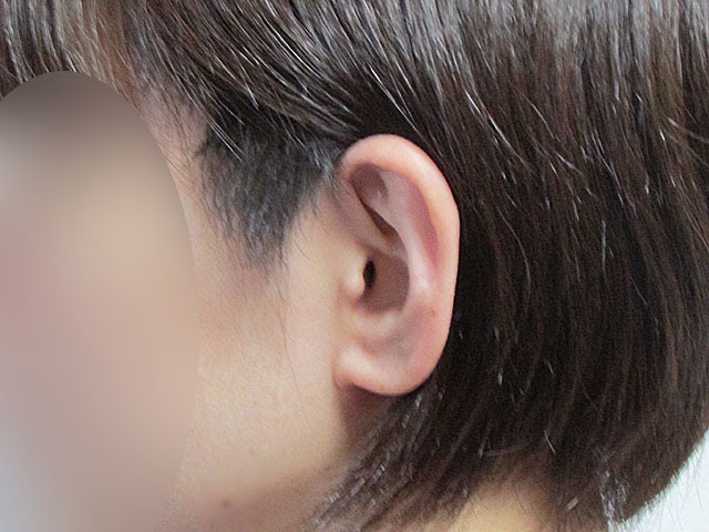 ツーブロック女子 伸びかけの刈り上げ １カ月目はこんな感じ みなこのブログ