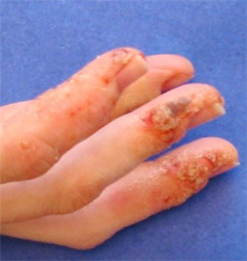 Itchy Skin No Rash: Causes, Symptoms, and Treatments