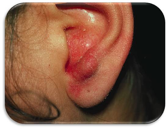 Pathologies