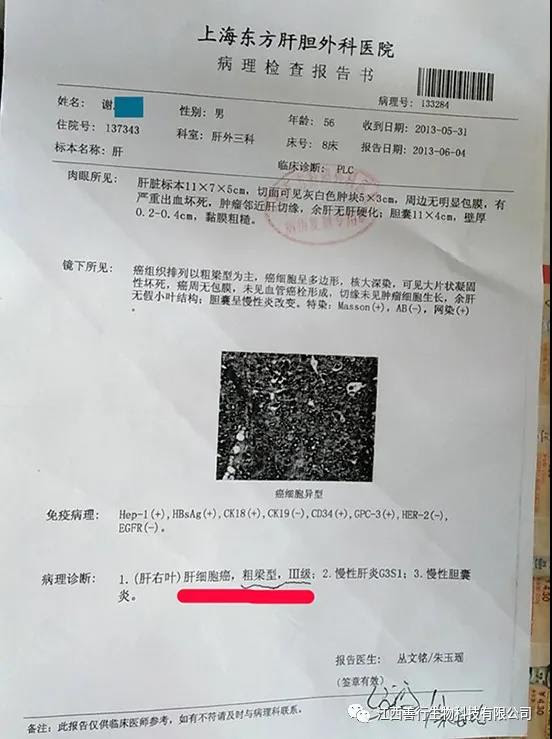 肝癌治愈7年复发又扩散 还有治么 江西善行生物科技有限公司