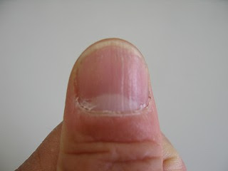 長野ダイハツ 木曽店 爪の縦線