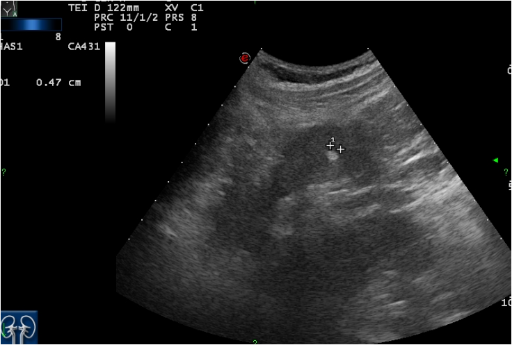 Diagnostische Bildgebung Des Urogenitaltraktes