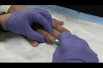 Home Remedies For Infected Finger