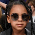 Beyonce Trivia Questions And Answers - Have lost a lot of my hair./ i have been on ozempic for a year.
