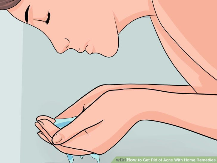 Get Rid of Acne With Home Remedies Step 4.jpg