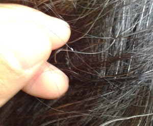 頭シラミとフケの見分け方 画像あり 取り方や孵化までの日数に注意