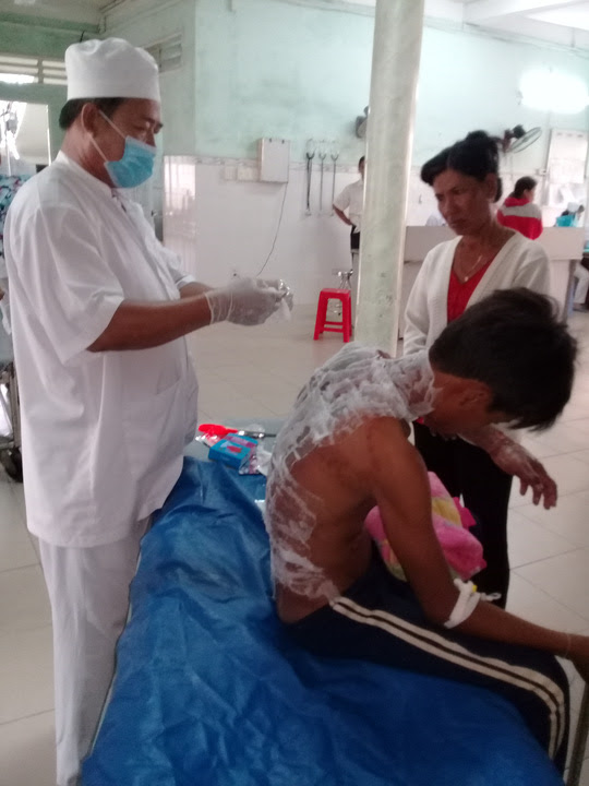 Dùng xăng đốt chuột, nam sinh cháy như ngọn đuốc - 1
