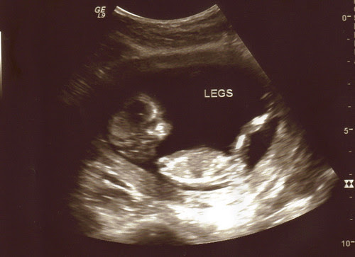baby 13 weeks 1
