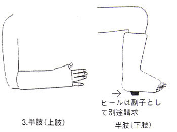 ギプスの点数と算定の仕方 レントゲン下で整復を見破ろう 医療事務向けレセプト算定技術 病名略語でレセプトチェックしよう