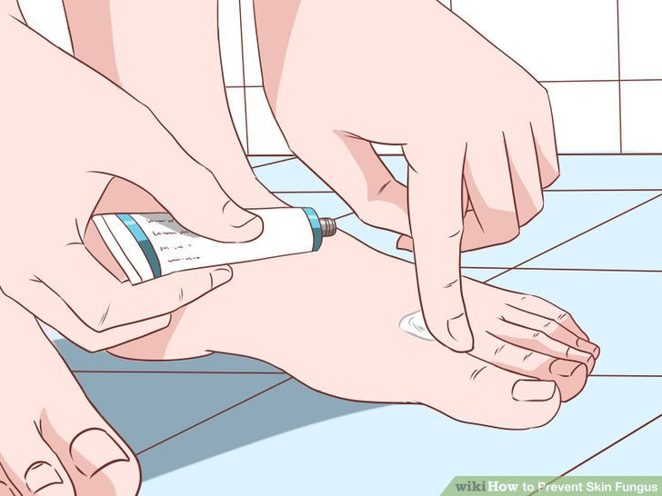 Prevent Skin Fungus Step 14.jpg