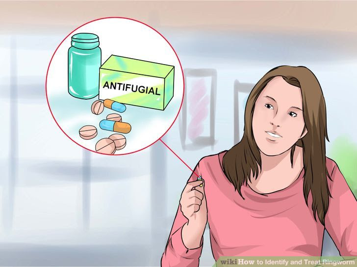 Identify and Treat Ringworm Step 15 Version 2.jpg