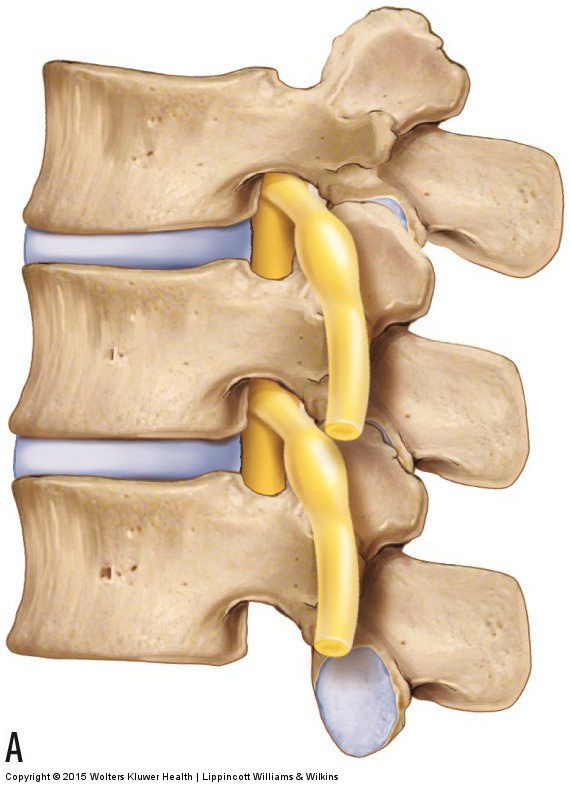 Degenerative Joint Disease Osteoarthritis Of The Low Back