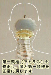 ｃ ａ予防医学センター アトラス療法