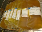30+ Darah Kuning, Gaya Terbaru!