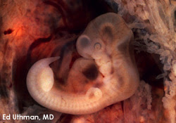 6e Semaine De Coaching Grossesse Comment Va Bebe En 6eme Semaine De Grossesse Aujourdhui Com