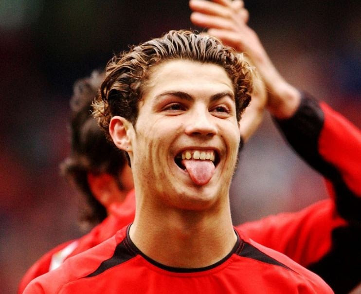 Cristiano Ronaldo, antes y después de la cirugía estética