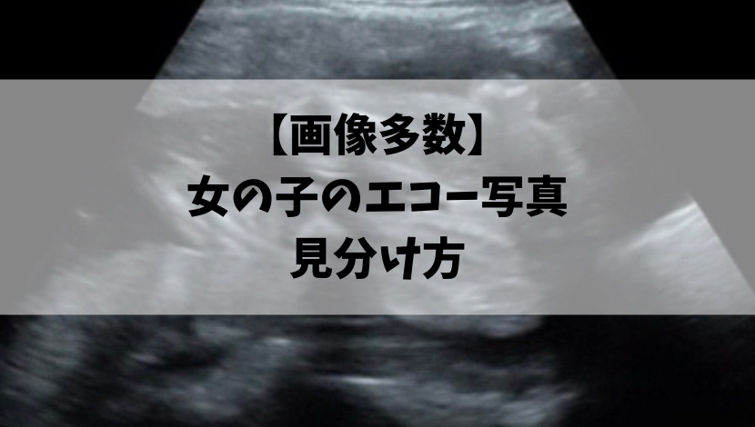写真多数 週数別女の子のエコーの見分け方 性別判定22 こそだて情報局