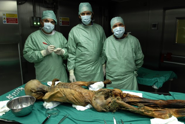 otzi