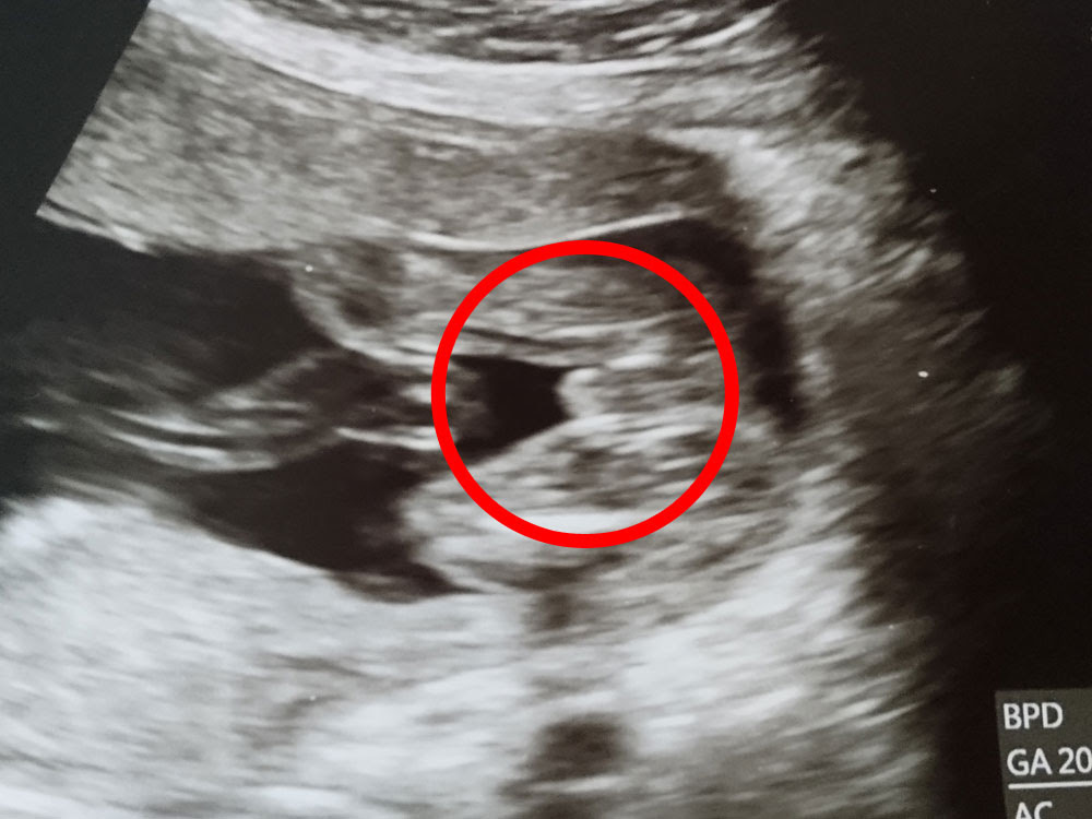 19週で性別判明 男の子と確定したエコー写真 ぽむらいふ おうちと暮らしを楽しむ