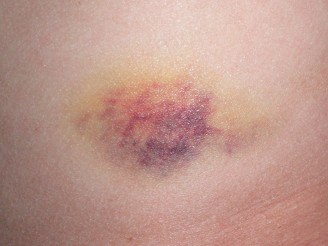 小畔川通信 ブンズ色とドドメ色