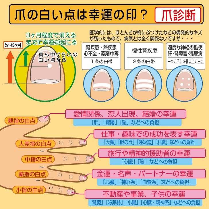 手相 これは幸運の兆候なの それとも病気の兆候 爪占い ウラスピナビ