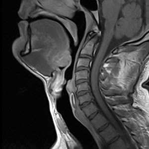 Untersuchungsbilder Mrt Kopf Schadel Hals Gemeinschaftspraxis Fur Neuroradiologie Und Radiologische Diagnostik Mrt Ct Berlin Prof Dr Jorg Planitzer Dr Maria Planitzer Neurologie Neuropadiatrie Hno Neuroophthalmologie