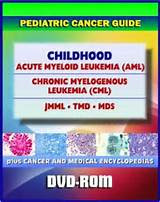 Photos of Jmml Leukemia Symptoms