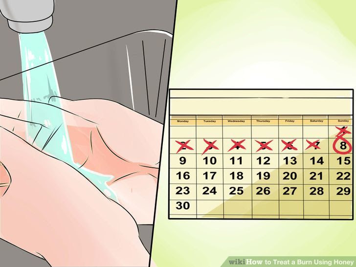 Treat a Burn Using Honey Step 20.jpg