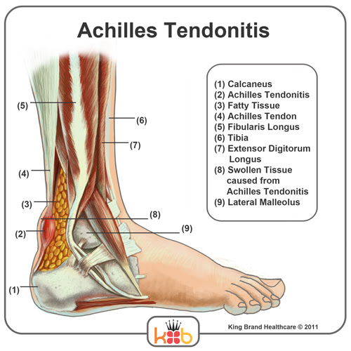 King Brand Ankle Images