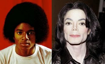 Cirurgias plásticas que geraram polêmica