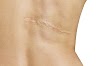 Skin Cancer Screening Near Me / Scar Revision - McLean Dermatology & Skincare Center : Find a free skin cancer screening near you.