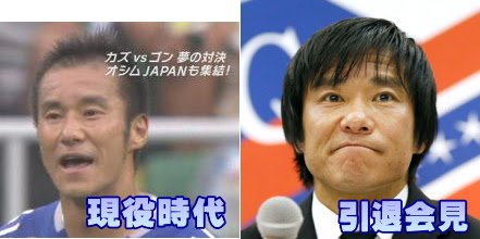 サッカー選手で植毛した人まとめ 生え際のｄｆラインは守り切る ウグイの本棚