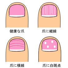 健康ブーム 爪が話題 健康美日の 癒しの応援歌