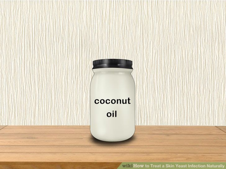 Treat a Skin Yeast Infection Naturally Step 4 Version 2.jpg