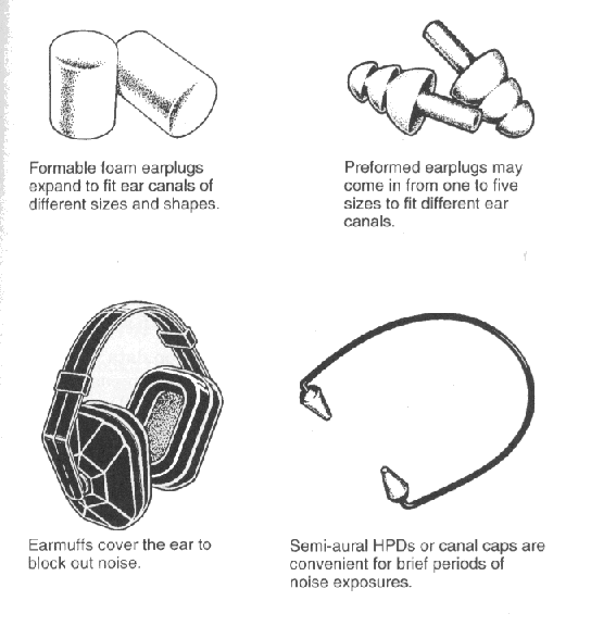 All HPDS attenuate noise by