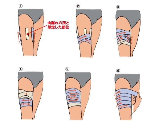 ケアポイント 株式会社ムトーエンタープライズ Mutoh Enterprises Ltd