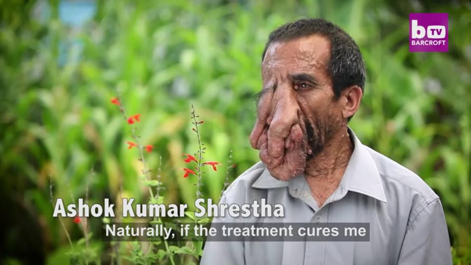 tumor 1