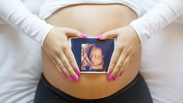 Arizona Ballot Measure Could Impact 2024 Presidential Race: '$100 Million to Promote Abortion'