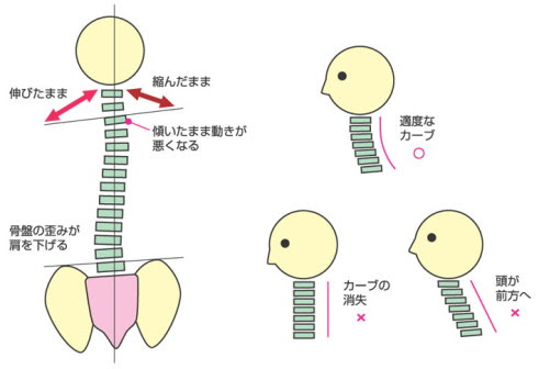 首 肩こりでお困りの方へ 横浜市金沢区の富岡西カイロプラクティック整体院