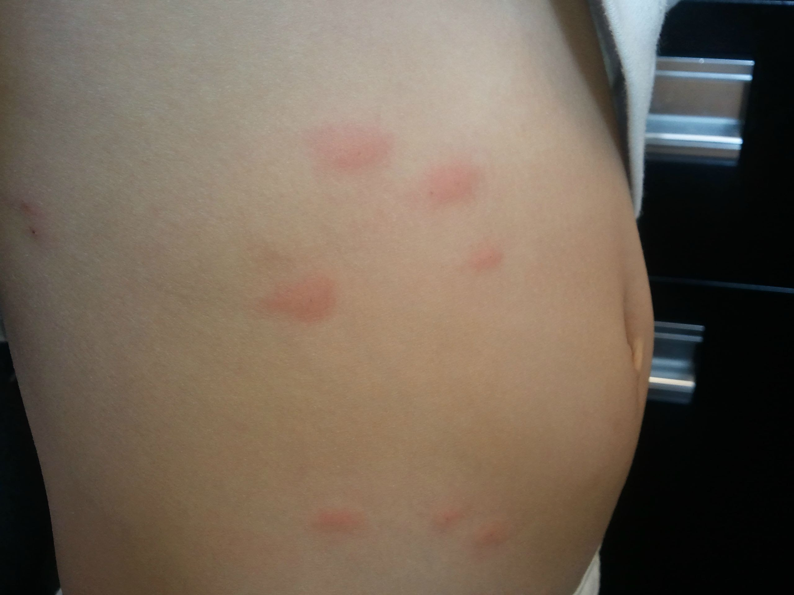 Bug ID needed - [a: weevil] Â« Got Bed Bugs? Bedbugger Forums