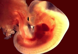 5e Semaine De Coaching Grossesse Comment Va Bebe En 5eme Semaine De Grossesse Aujourdhui Com