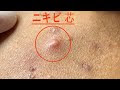 [最も選択された] 犬 吹き出物 白い 182344-犬 吹き出物 白い