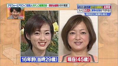 石田ゆり子と同世代アラフィフ有名人の老化の差が歴然 大神いずみは顔がなだれ 高須院長が美の秘訣と老化の原因を明かす 芸能人のゴシップ日記
