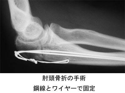 痛みの話q A 八王子整形外科 西八王子駅近くの整形外科専門クリニック