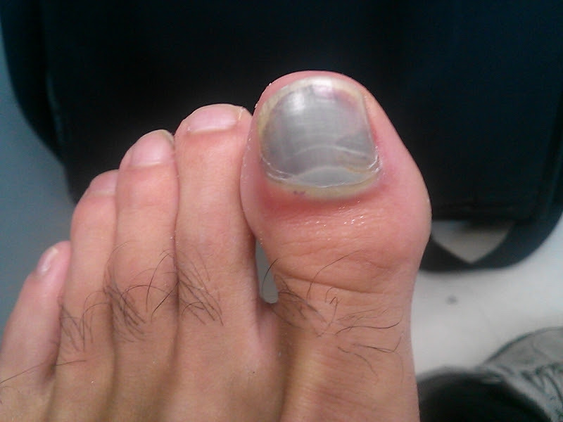 峰山でハチミツとれたけん 運動の秋 ソフトボール サッカー