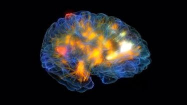 Glass Brain Provides Researchers With a Window Into the Mind